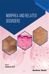 Book cover of Morphea and Related Disorders by Tasleem Arif