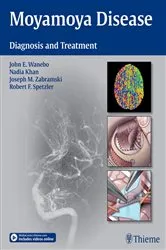 Book cover of Moyamoya Disease by John E. Wanebo