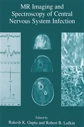 Book cover of MR Imaging and Spectroscopy of Central Nervous System Infection by Rakesh K. Gupta