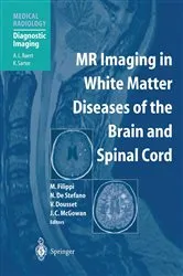 Book cover of MR Imaging in White Matter Diseases of the Brain and Spinal Cord by Massimo Filippi