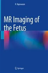 Book cover of MR Imaging of the Fetus by R. Rajeswaran