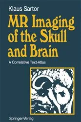 Book cover of MR Imaging of the Skull and Brain by Klaus Sartor