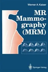 Book cover of MR Mammography (MRM) by Werner A. Kaiser