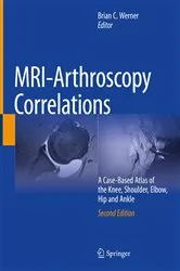 Book cover of MRI-Arthroscopy Correlations (2nd ed.) by Brian C. Werner
