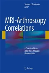 Book cover of MRI-Arthroscopy Correlations by Stephen F. Brockmeier