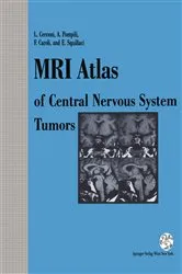 Book cover of MRI Atlas of Central Nervous System Tumors by Unknown