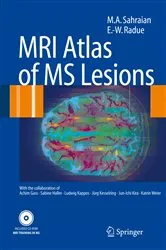 Book cover of MRI Atlas of MS Lesions by Unknown