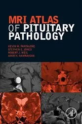 Book cover of MRI Atlas of Pituitary Pathology by Pantalone DO, ECNU, CCD, Kevin M.