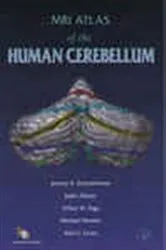 Book cover of MRI Atlas of the Human Cerebellum by Jeremy D. Schmahmann