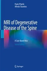 Book cover of MRI of Degenerative Disease of the Spine (2nd ed.) by Paola D'Aprile