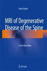 Book cover of MRI of Degenerative Disease of the Spine by Paola D'Aprile