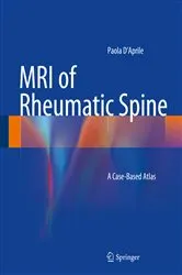 Book cover of MRI of Rheumatic Spine by Paola D’Aprile