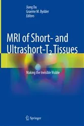 Book cover of MRI of Short- and Ultrashort-T2 Tissues by Jiang Du