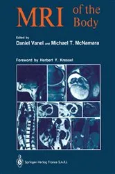 Book cover of MRI of the Body by Daniel Vanel