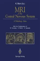 Book cover of MRI of the Central Nervous System by M. Kurisaka