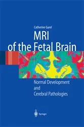 Book cover of MRI of the Fetal Brain by C. Garel