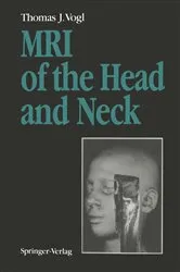 Book cover of MRI of the Head and Neck by Thomas J. Vogl