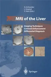 Book cover of MRI of the Liver by Günther Schneider