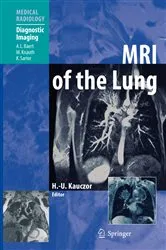 Book cover of MRI of the Lung by Hans-Ulrich Kauczor