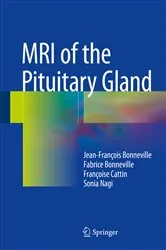 Book cover of MRI of the Pituitary Gland by Unknown