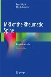 Book cover of MRI of the Rheumatic Spine (2nd ed.) by Paola D'Aprile