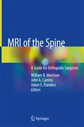 Book cover of MRI of the Spine by William B. Morrison