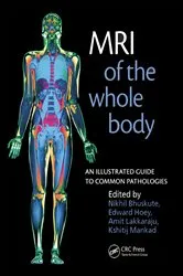 Book cover of MRI of the Whole Body by Nikhil Bhuskute