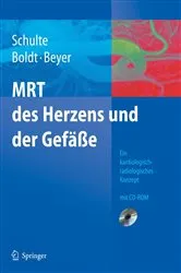 Book cover of MRT des Herzens und der Gefäße by B. Schulte