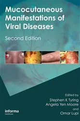 Book cover of Mucocutaneous Manifestations of Viral Diseases (2nd ed.) by Stephen Tyring