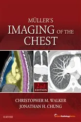 Book cover of Muller's Imaging of the Chest E-Book (2nd ed.) by Christopher M. Walker MD