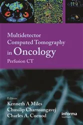 Book cover of Multi-Detector Computed Tomography in Oncology by Kenneth Miles