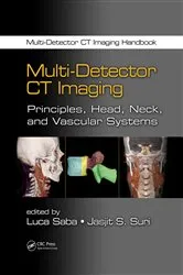 Book cover of Multi-Detector CT Imaging by Luca Saba