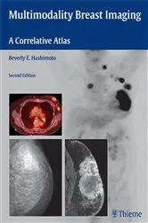 Book cover of Multimodality Breast Imaging (2nd ed.) by Beverly Hashimoto