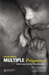 Book cover of Multiple Pregnancy (2nd ed.) by Unknown