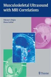 Book cover of Musculoskeletal Ultrasound with MRI Correlations by Vikram S. Dogra