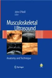 Book cover of Musculoskeletal Ultrasound by John M. D. O'Neill