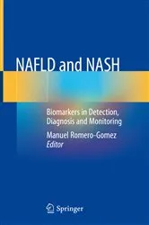 Book cover of NAFLD and NASH by Unknown