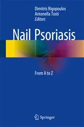 Book cover of Nail Psoriasis by Dimitris Rigopoulos