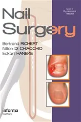 Book cover of Nail Surgery by Bertrand Richert