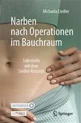 Book cover of Narben nach Operationen im Bauchraum by Michaela Liedler