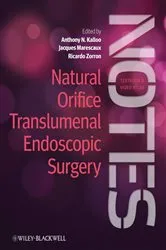 Book cover of Natural Orifice Translumenal Endoscopic Surgery (NOTES) by Anthony N. Kalloo