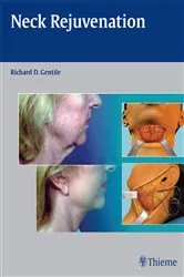 Book cover of Neck Rejuvenation by Richard D. Gentile