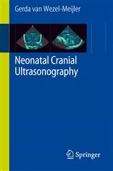 Book cover of Neonatal Cranial Ultrasonography by Unknown