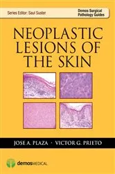 Book cover of Neoplastic Lesions of the Skin by Jose Plaza