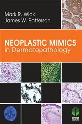 Book cover of Neoplastic Mimics in Dermatopathology by Mark R. Wick