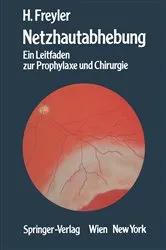 Book cover of Netzhautabhebung by Heinrich Freyler