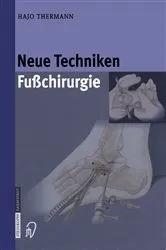Book cover of Neue Techniken Fusschirurgie by Hajo Thermann