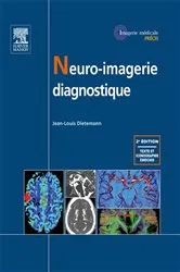 Book cover of Neuro-imagerie diagnostique (2nd ed.) by Jean-Louis Dietemann