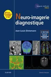 Book cover of Neuro-imagerie diagnostique (3rd ed.) by Jean-Louis Dietemann