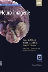 Book cover of Neuro-imagerie by Osborn MD, FACR, Anne G.